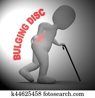 Bulging Disc Showing Back Chiropractor 3d Rendering Bulging Disc Showing Back Chiropractor 3d Rendering