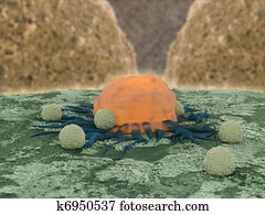 cancer cell with lymphocytes cancer cell with lymphocytes