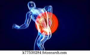 Man suffering from severe back pain Man suffering from severe back pain