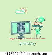 phthisiatry, רנטגן של חזה, מראה