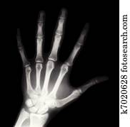 רנטגן, העבר., וקטור