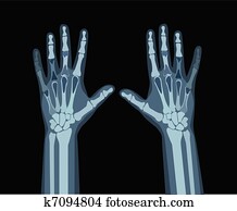 x-ray hands x-ray hands