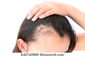 Woman serious hair loss problem for health care shampoo and beauty product concept Woman serious hair loss problem for health care shampoo and beauty product concept