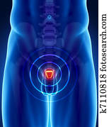 סרטן של ערמונית, מושג