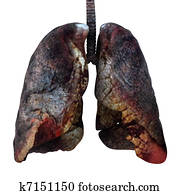 Cancered, pulmões, isolado, ligado, white., 3d, render