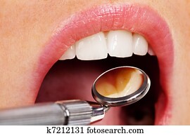 the dentist the dentist