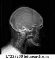 Cranium Cranium