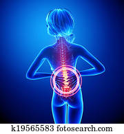 Female back pain anatomy Female back pain anatomy