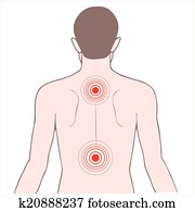 back and neck pain back and neck pain