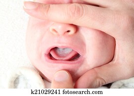 אוראלי, קיכלי