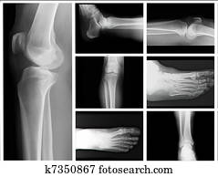 X-ray X-ray