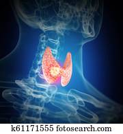 thyroid cancer thyroid cancer