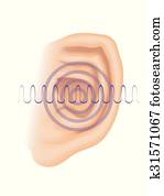 tinnitus tinnitus