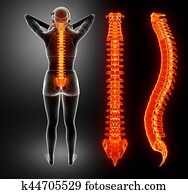 Women Feeling the Back pain Women Feeling the Back pain