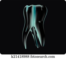 רנטגן, של, ה, שן