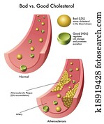 cholesterol cholesterol