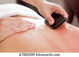Gua-Sha, acupuntura, tratamento, ligado, costas