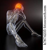 Head Pain concept Head Pain concept