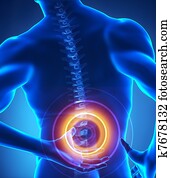 חוט שדרה, בעיה, רנטגן, הבט