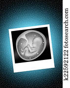 ultrasound in pregnancy ultrasound in pregnancy