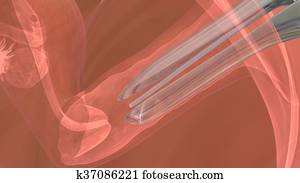 Process of embryo transfer Process of embryo transfer