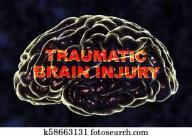 Traumatic brain injury Traumatic brain injury
