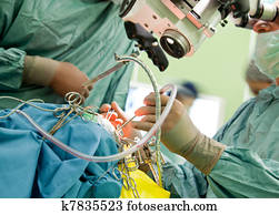 Brain surgery Brain surgery