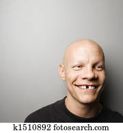 Man with missing tooth.