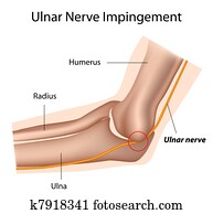 Ulnar nerve and cubital tunnel, eps8 Ulnar nerve and cubital tunnel, eps8