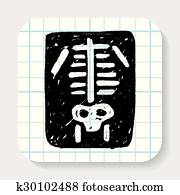 רנטגן, שרבט