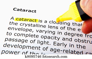Cataract Cataract