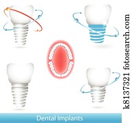 של השיניים, משריש