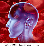 Brain stroke Brain stroke