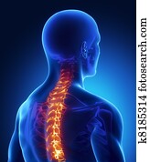 espinha dorsal, ferimento, em, raio x