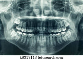 xray dental