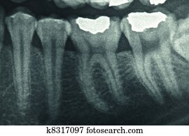 xray dental