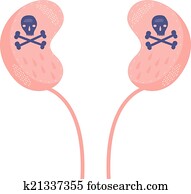 Kidney Disease Kidney Disease