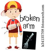 בחור, עם, עצם שבור, ו, רנטגן