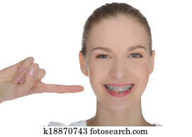Smiling happy girl indicates braces on teeth
