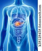 pancreas cancer pancreas cancer