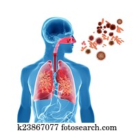 pólen, alergia, /, feno, fever/, influenza, infecção