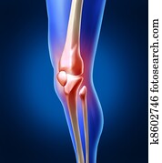 menselijke knie, pijn