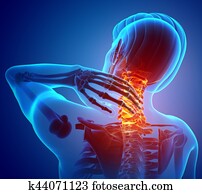 Male Feeling the Neck Pain