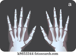 דמות של רנטגן, של, hands,, וקטור, דוגמה