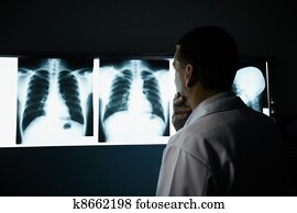 doutor, trabalhando, em, hospitalar, durante, exame, de, raios x