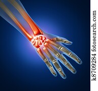 Hand Pain