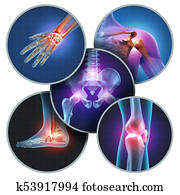 Human Painful Joints Human Painful Joints