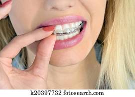 Woman with mouthguard Woman with mouthguard