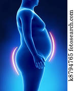 Obesity female fat lines Obesity female fat lines