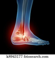 Ankle Foot Pain